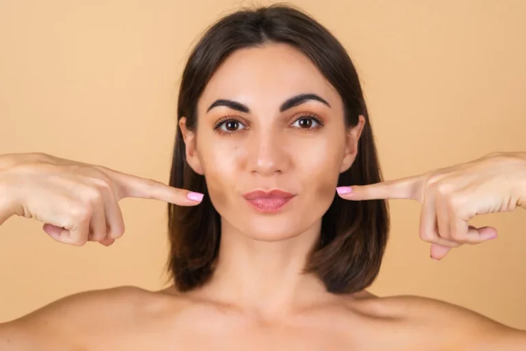 facial hair due to pcos